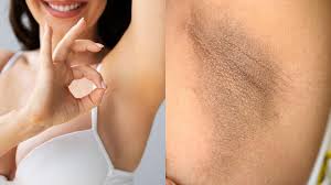 ¡Axilas sin mal olor, sin irritaciones y sin manchas oscuras!