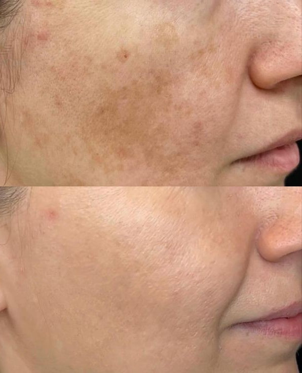 Kit Mi Origen - Para una piel radiante