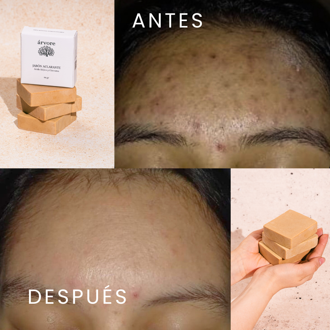 Sin manchas oscuras o cicatrices por acné - Barra Aclarante