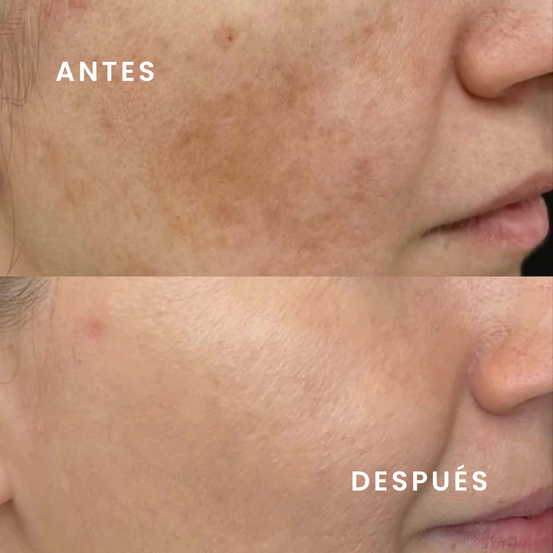 Aceite facial equilibrante árvore