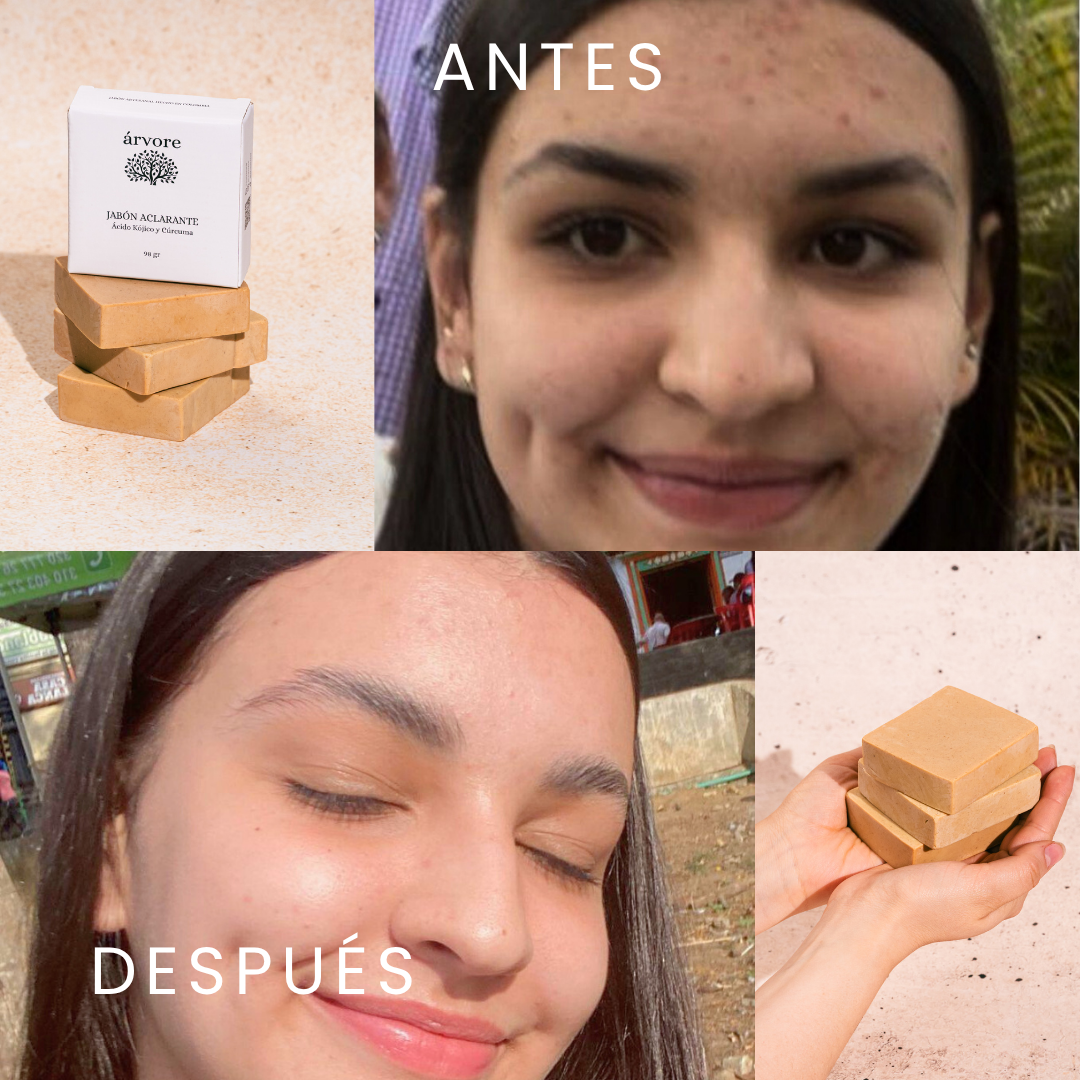 Jabón en barra Aclarante con Cúrcuma y Ácido Kójico